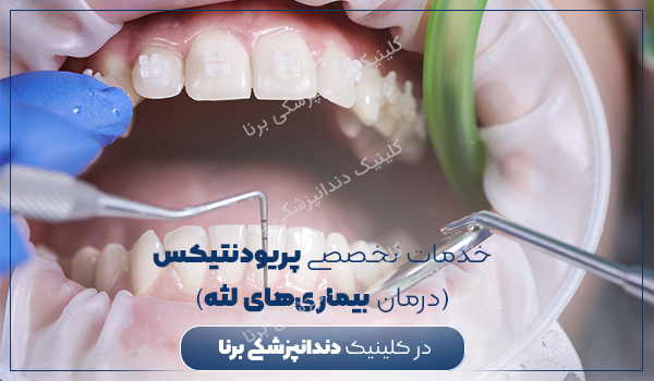 پریودنتیکس(درمان‌های لثه) در شیراز